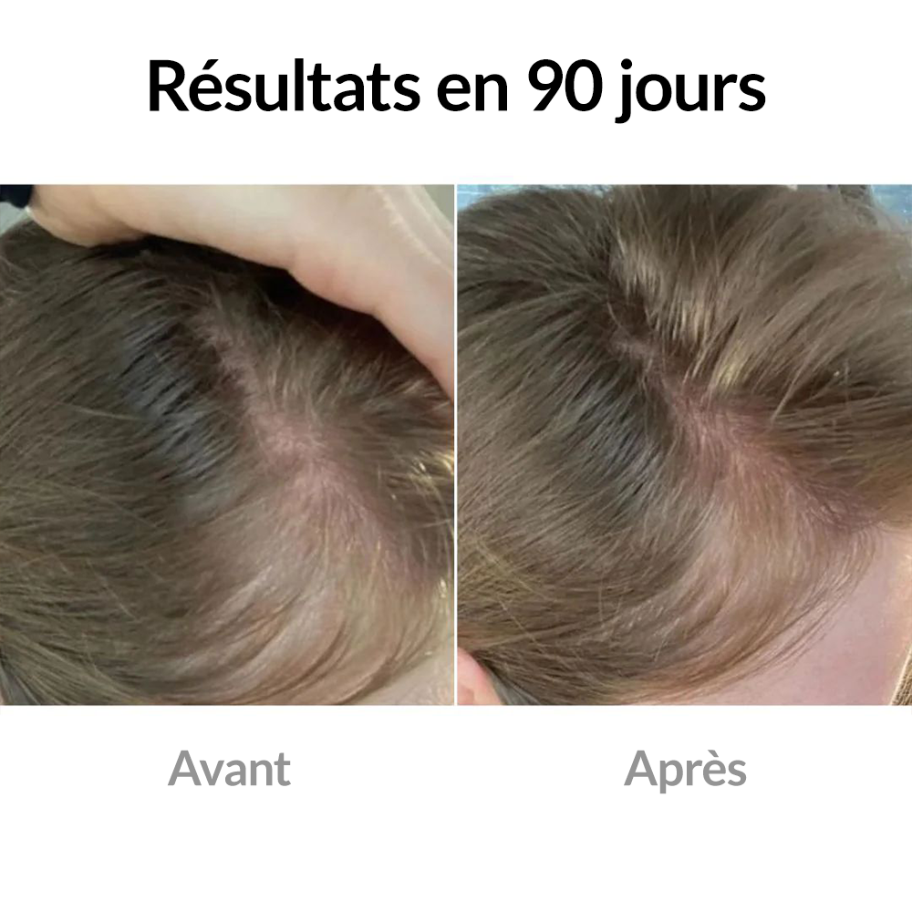 TheraCare - Brosse multifonctionnelle
